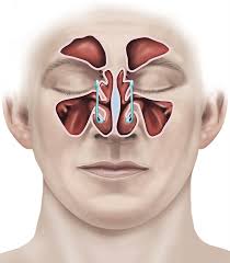 Sinus Surgery $2300